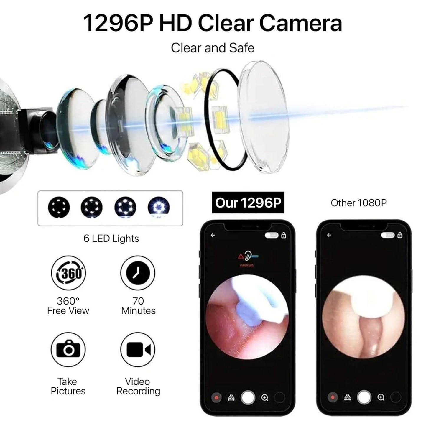 Smart Visual Ear Wax Cleaner with WiFi Camera – Ear Cleaning Kit with 6 Silicone Tips & 8-Piece Tool Set (Pack of 1)